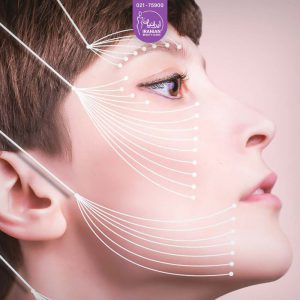 Yarn lift - face madleing with yarn lift