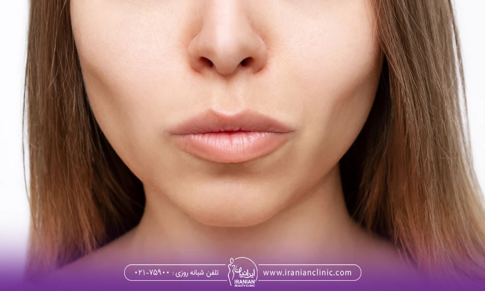 Side Effects and Risks of Buccal Fat Removal