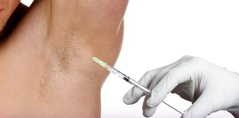 A person with a doctor doing the armpit Botox
