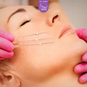 عکس نخ لیفت روی صورت زن جوان