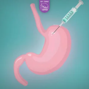 تصویر وکتور معده که یک سرنگ حاوی بوتاکس به آن تزریق می شود - بوتاکس معده