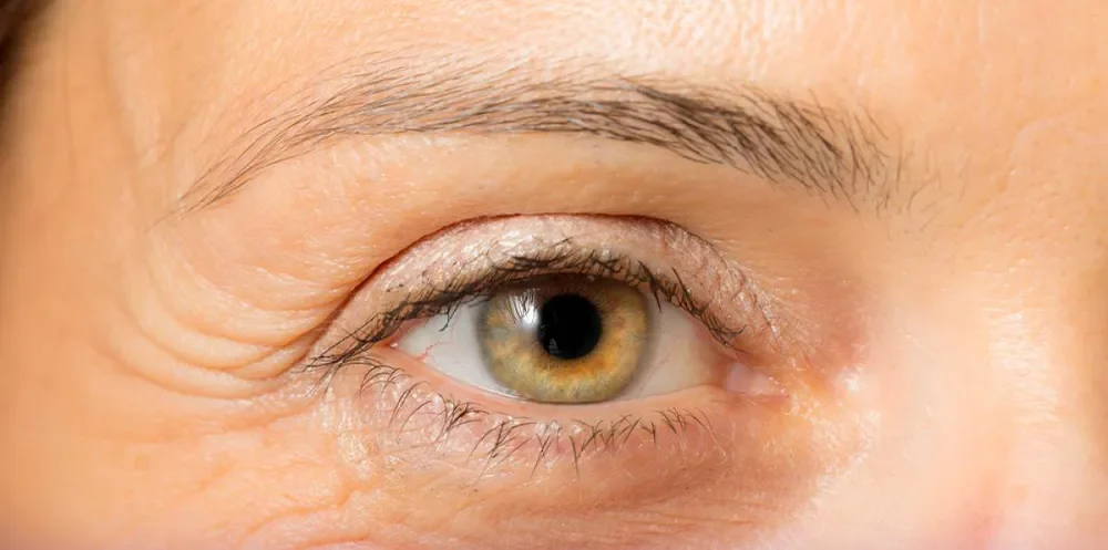 The eyes and eyebrows of the person who sets the lines next to his eyes.