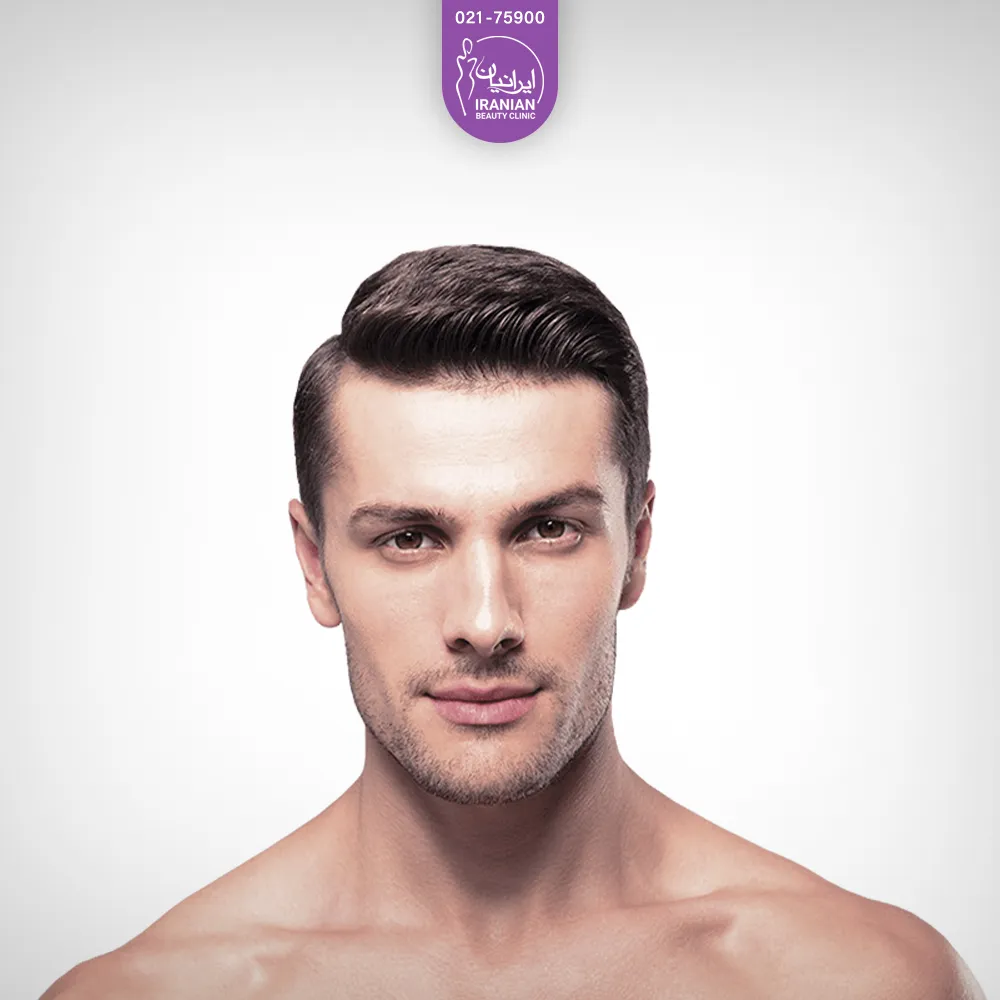 Buccal Fat Removal for Men