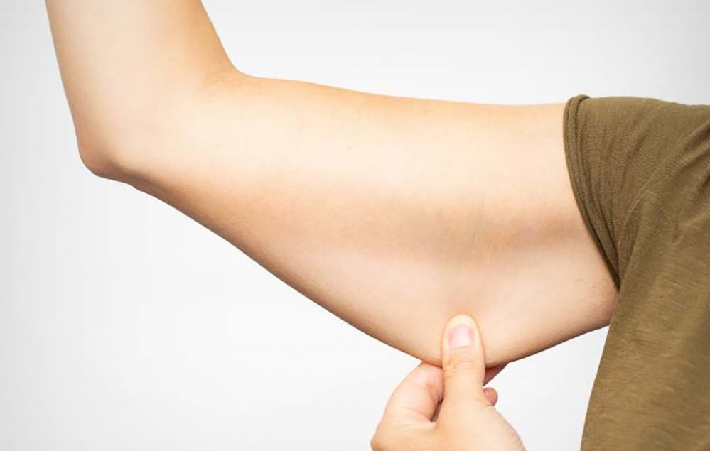 ورزش برای افتادگی بازو - رفع شلی بازو