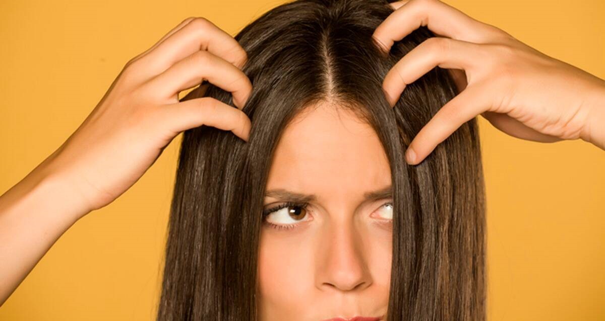 رفع شوره مو - درمان موهای چرب و شوره دار