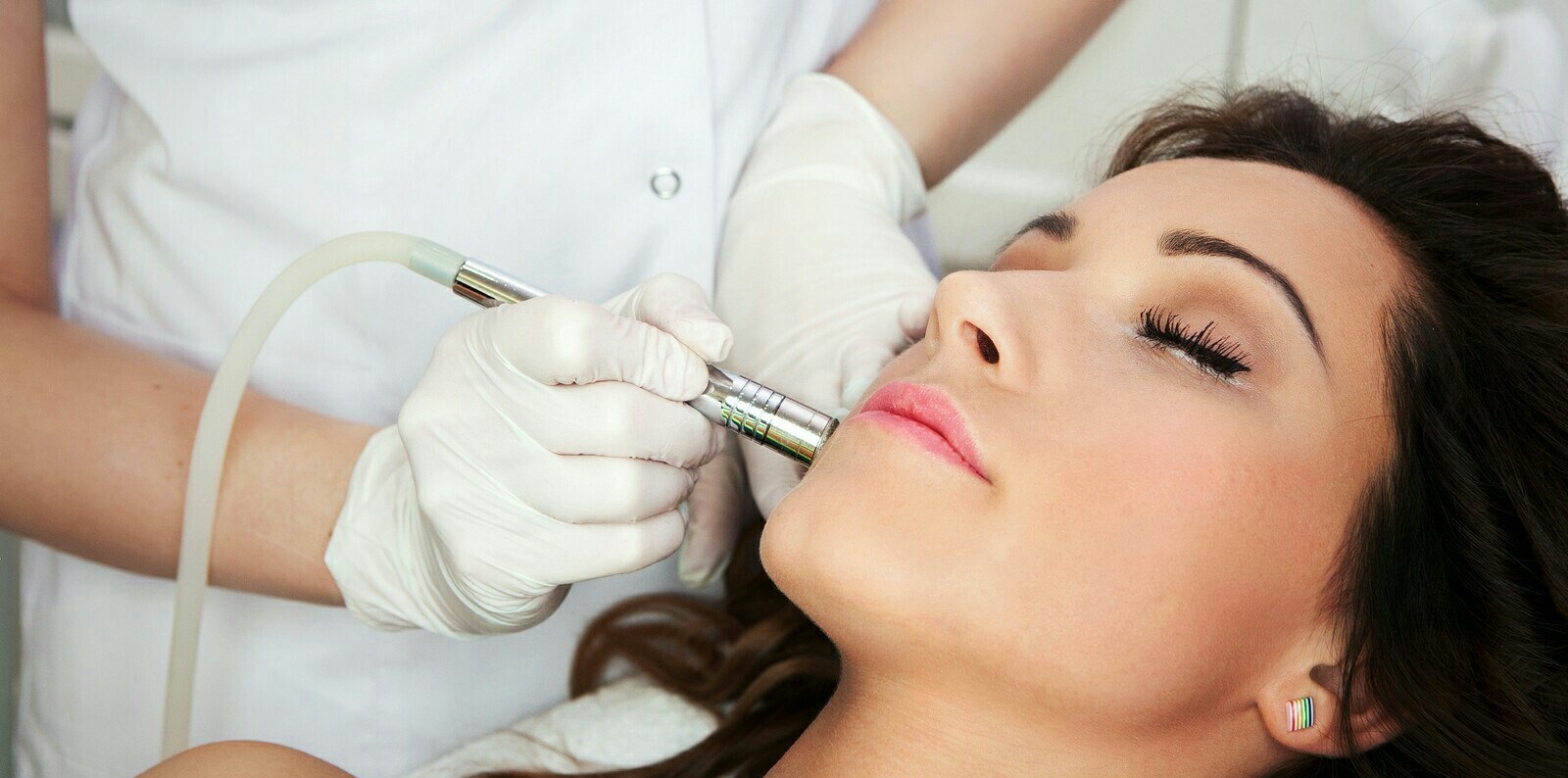 میکرودرم - از بین بردن جای جوش