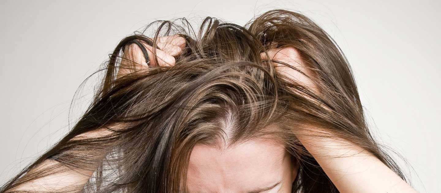 موهای گره خورده - درمان موهای چرب و شوره دار