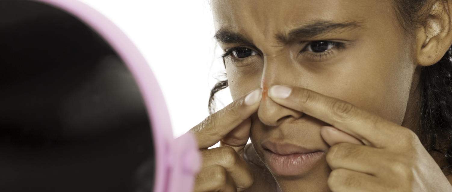 فشار دادن جوش - از بین بردن جای جوش