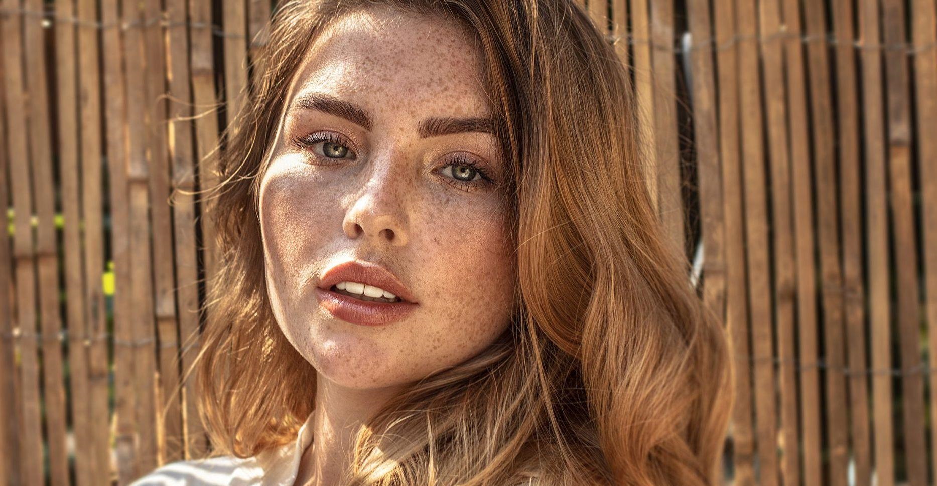 کک و مک صورت - برنزه كردن با آفتاب