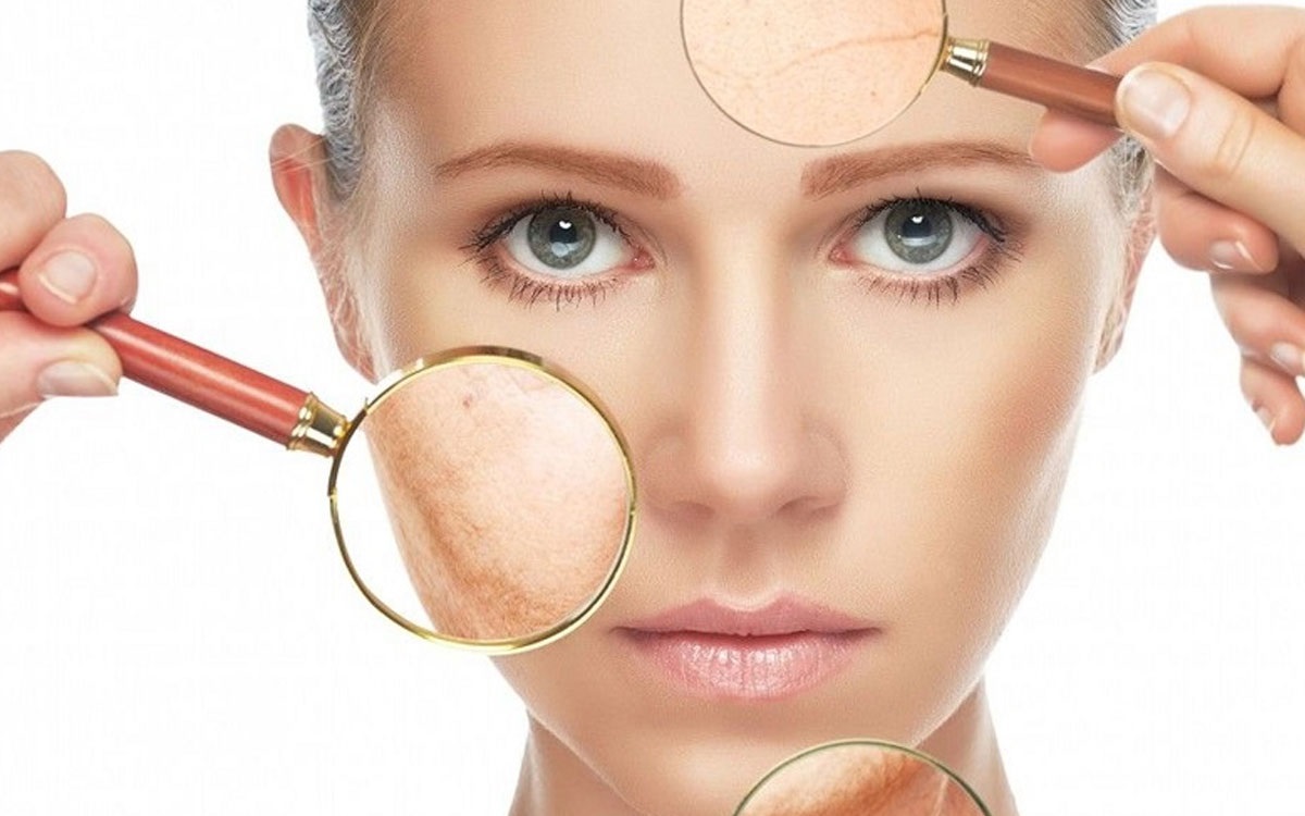 خشکی پوست - خشکی پوست صورت