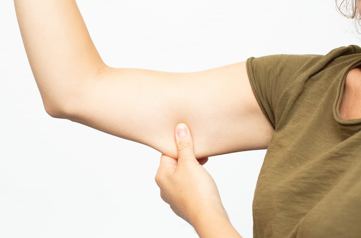 افتادگی عضلات بازو - رفع شلی بازو