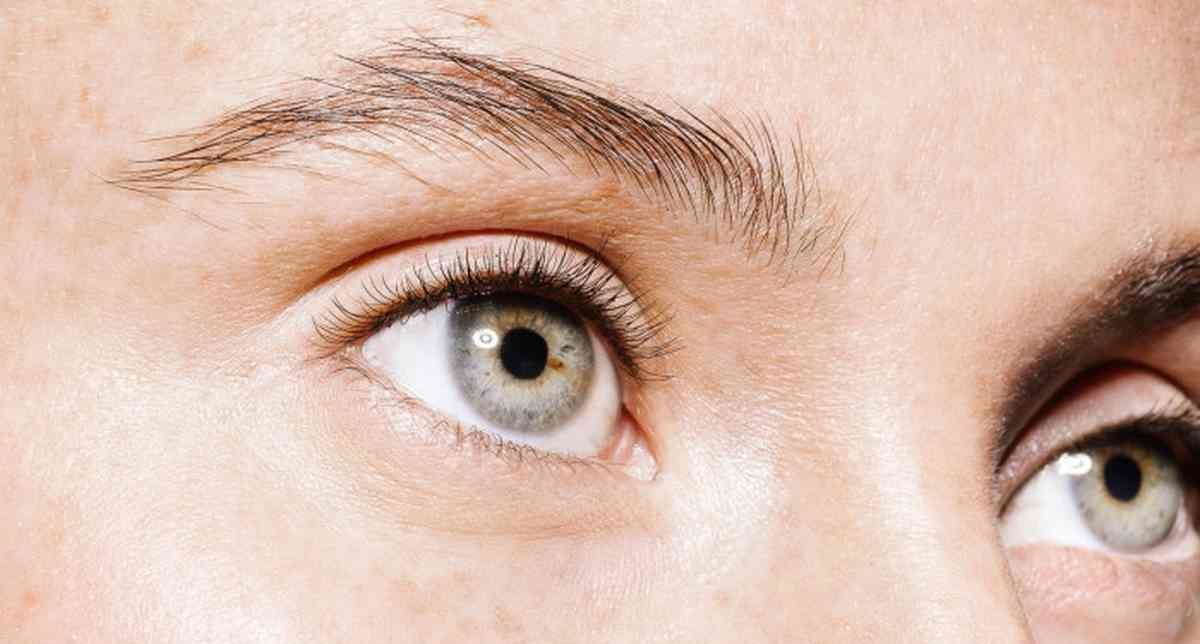 جوش های چربی زیر چشم - درمان خانگی میلیا چشم