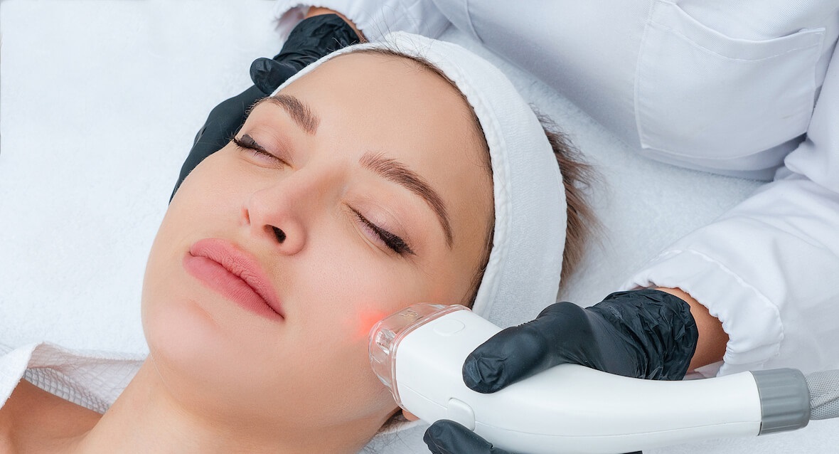 لیزر فرکشنال - از بین بردن جای جوش