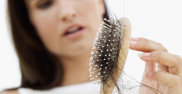 درمان ریزش مو