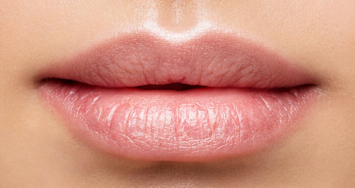 لیفت لب با نخ - برجسته کردن لب