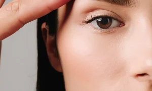 افتادگی پلک - آرایش پلک افتاده