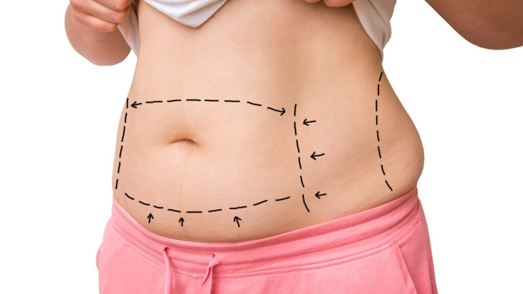 رژیم لاغری شکم و پهلو - درمان چاقی شکم