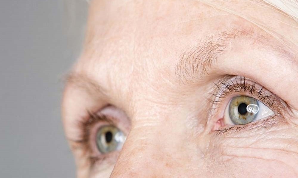 ریزش ابرو - درمان ریزش ابرو