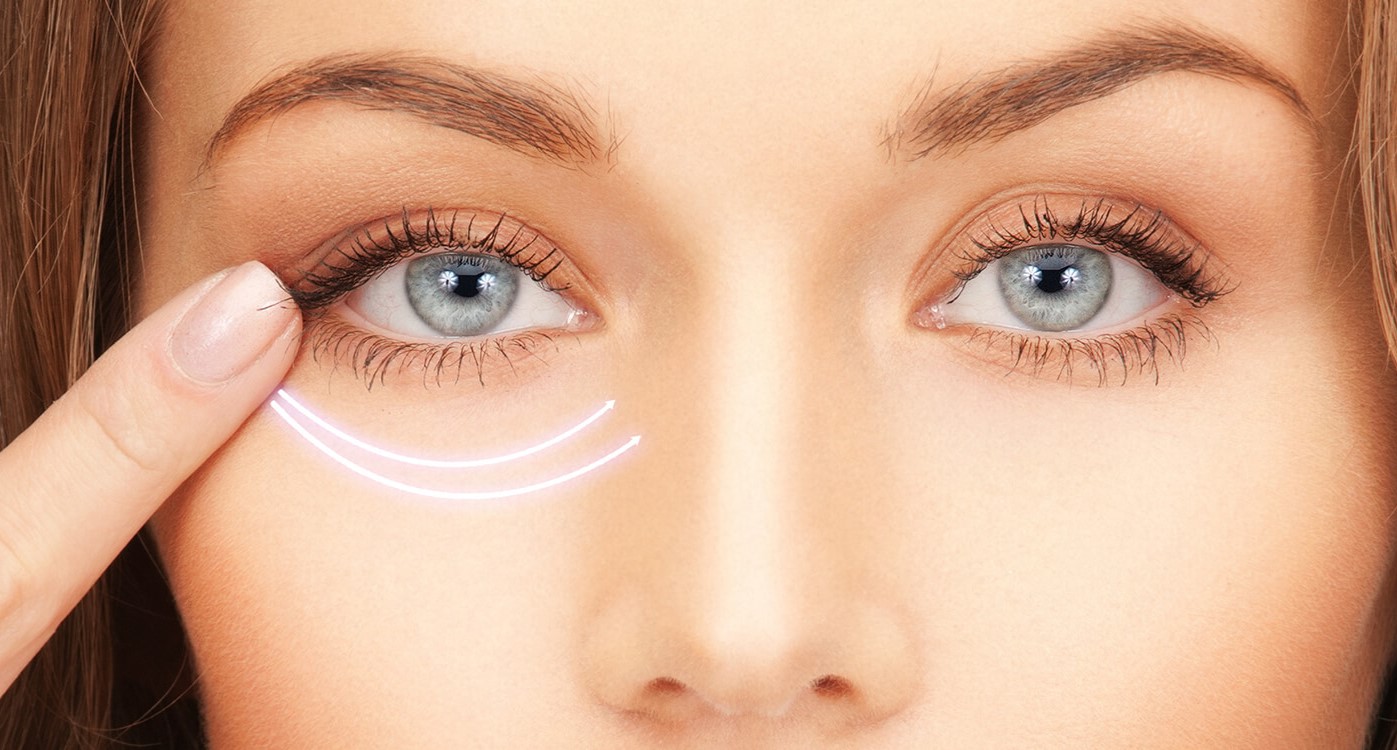 درمان تیرگی زیر چشم - رفع تیرگی زیر چشم