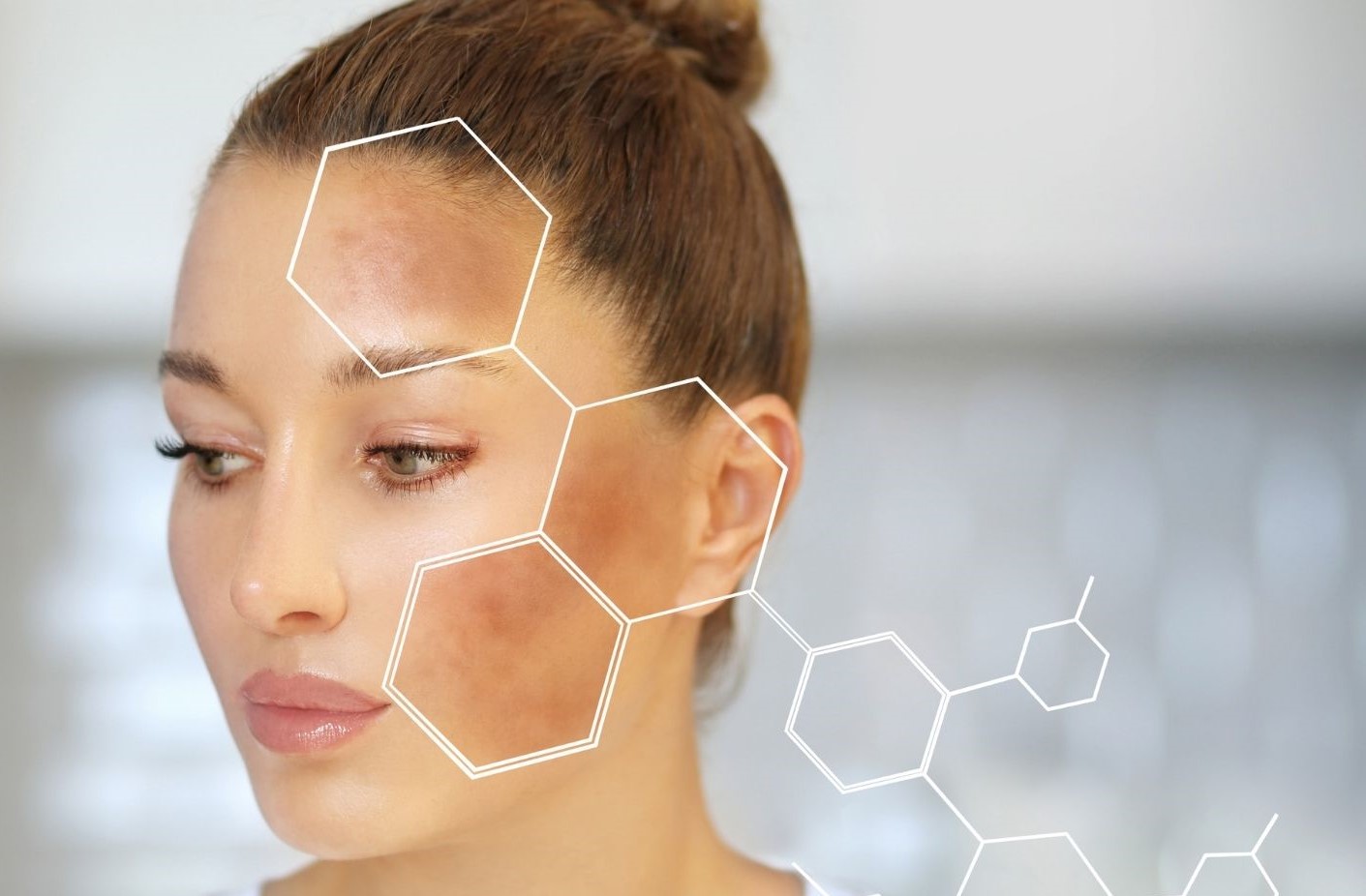 لکه های پوستی صورت - انواع لکه های پوستی