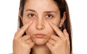 رفع تیرگی زیر چشم