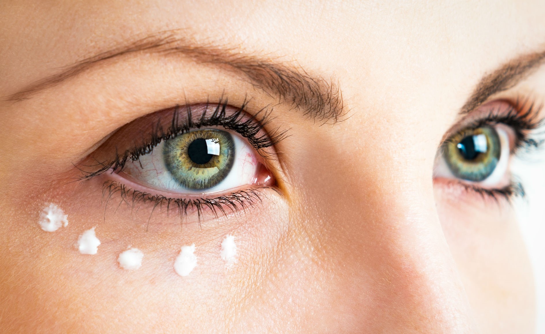 کرم برای تیرگی زیر چشم - رفع تیرگی زیر چشم