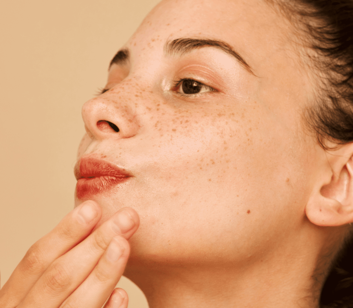 درمان لک صورت - کلخنگ برای لک صورت