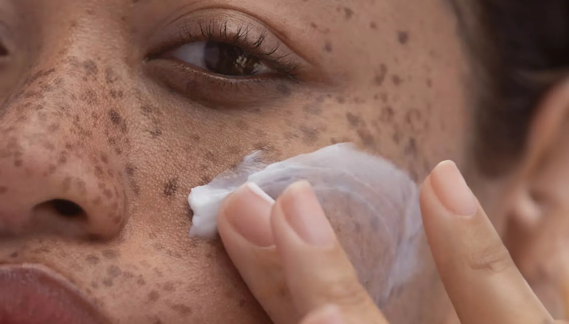 از بین بردن لک قهوه ای صورت - بهترین کرم ضد لک صورت خارجی