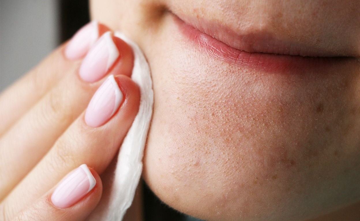 منافذ باز پوست - درمان منافذ باز پوست در خانه