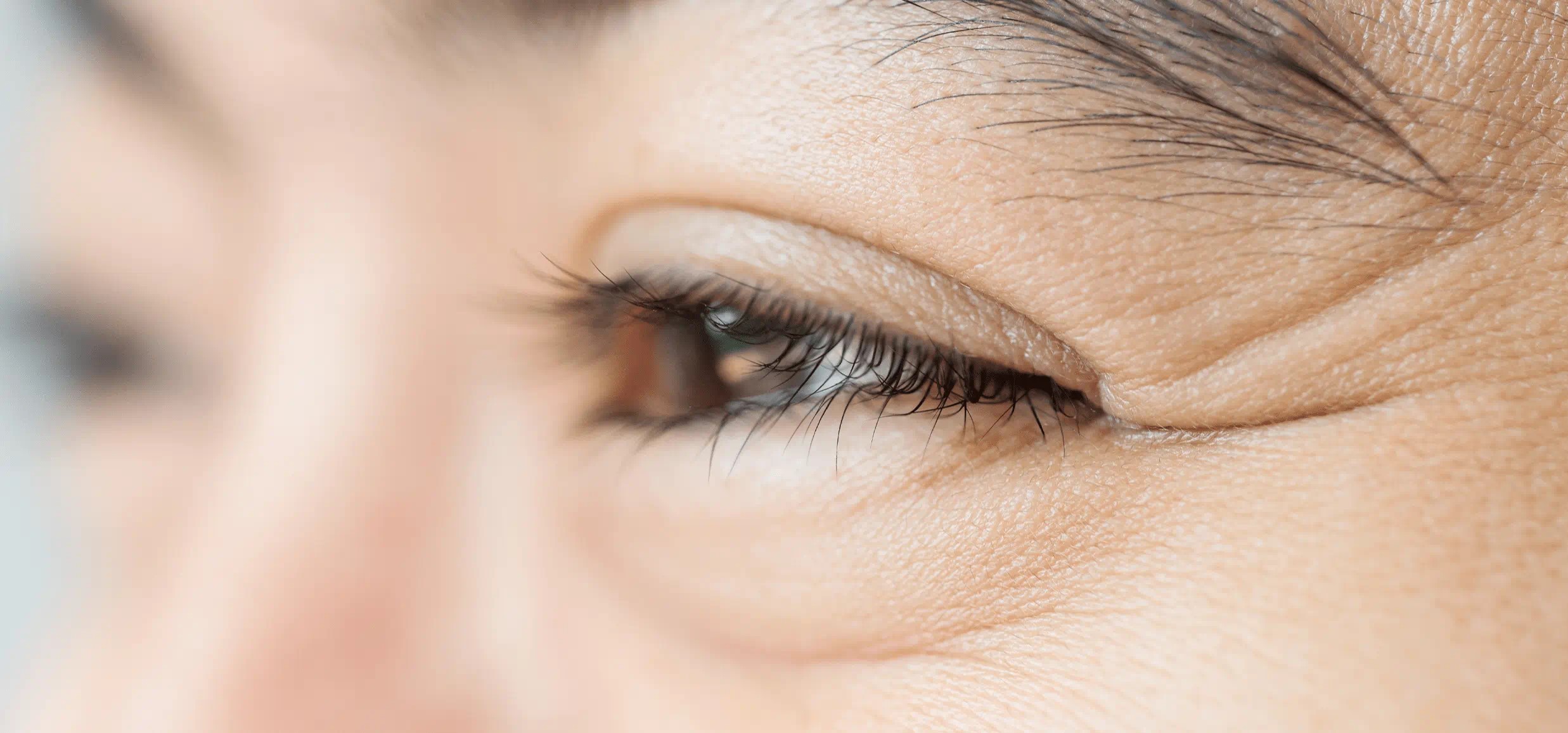 چروک پنجه کلاغی - کرم رفع چروک پنجه کلاغی