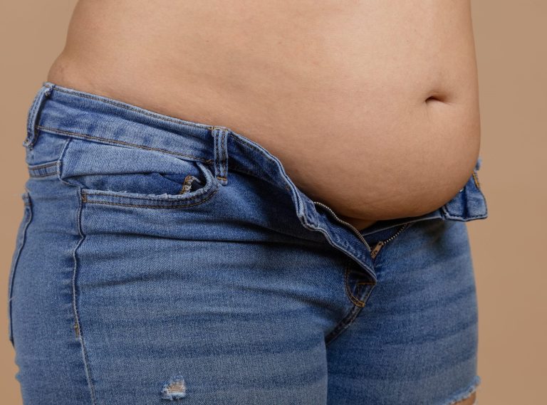 چاقی شکم در افراد لاغر