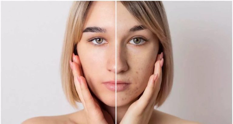 زاج سفید برای روشن شدن پوست