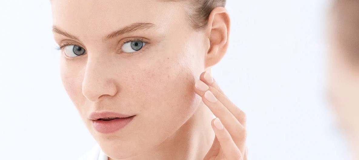 علت جوش روی چانه - علت جوش در نواحی مختلف صورت