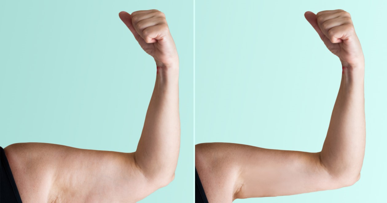 لاغر کردن بازو - لاغری بازو در خانه