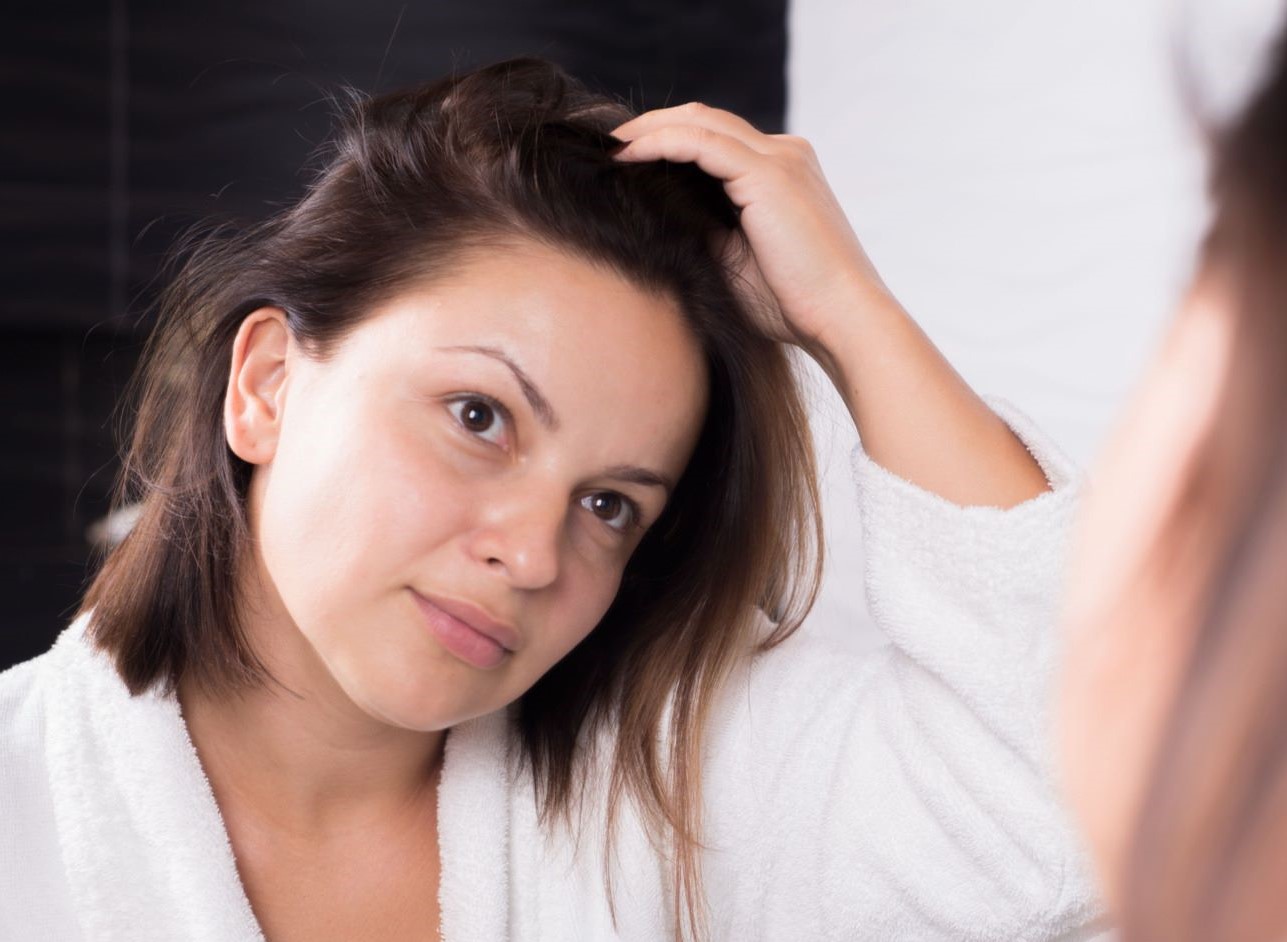 رفع دائمی چربی پوست سر زنان