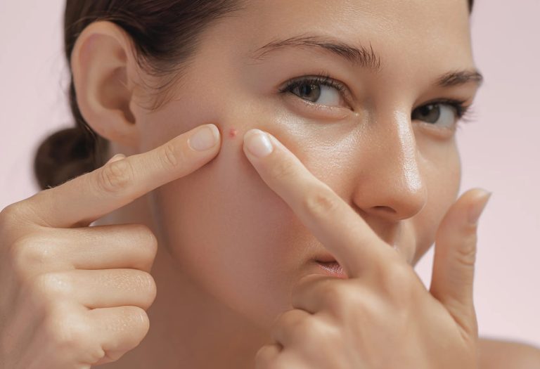 علت جوش در نواحی مختلف صورت