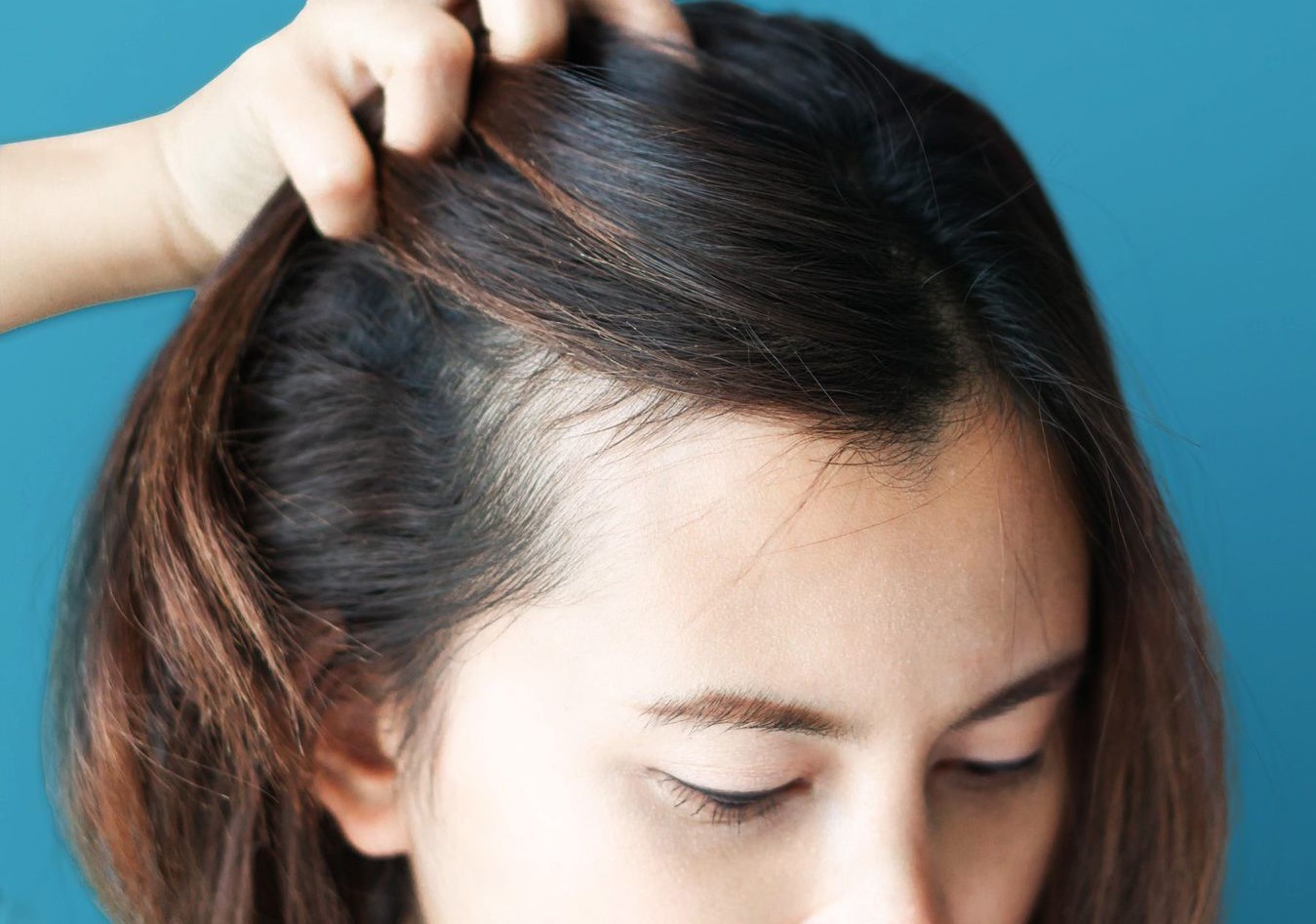 درمان موی چرب - رفع دائمی چربی پوست سر