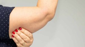 لاغری بازو در خانه