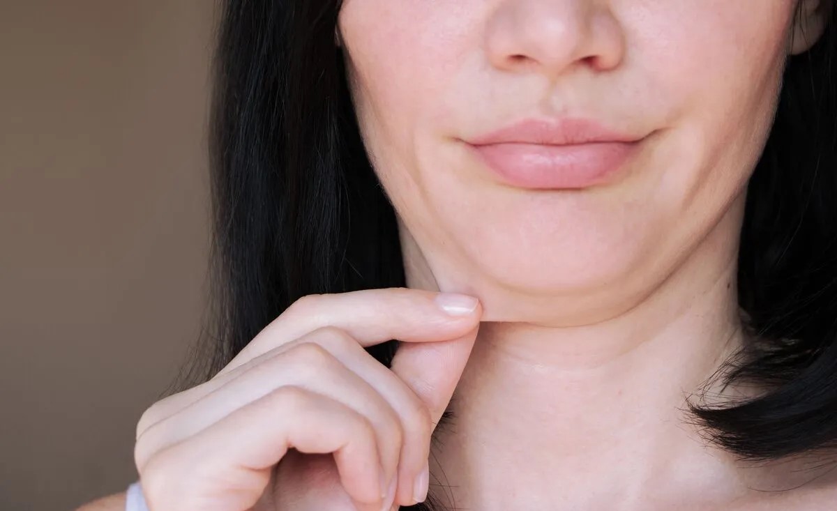 علت چاقی صورت - علت چاقی ناگهانی صورت