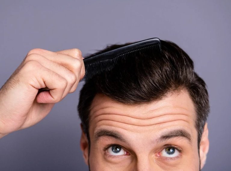 رفع دائمی چربی پوست سر