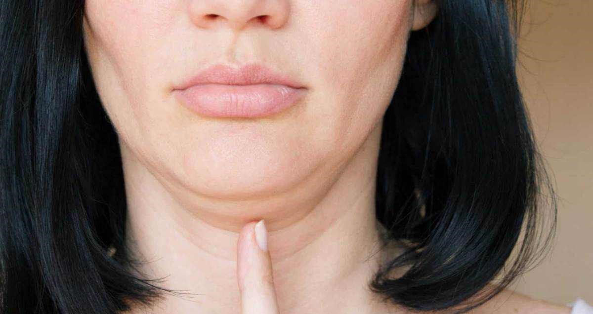 رفع غبغب - زاویه دار کردن فک با ورزش