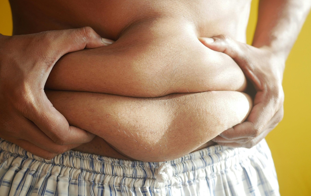 چاقی ارثی - درمان چاقی ژنتیکی