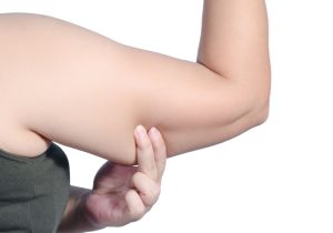 لاغری سریع بازو در یک هفته