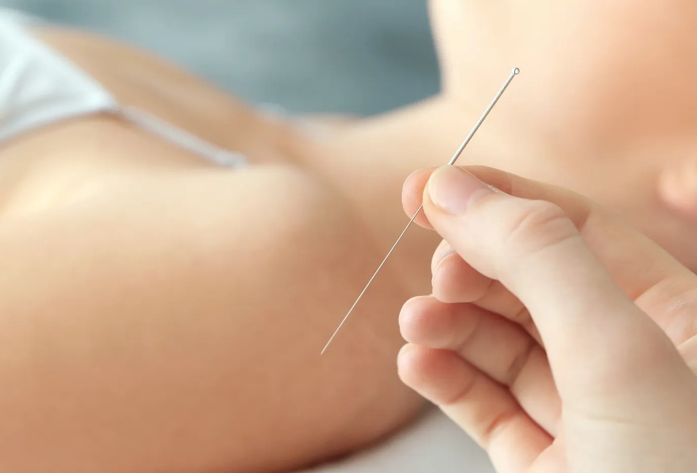 فواید طب سنتی - لاغری با طب سوزنی