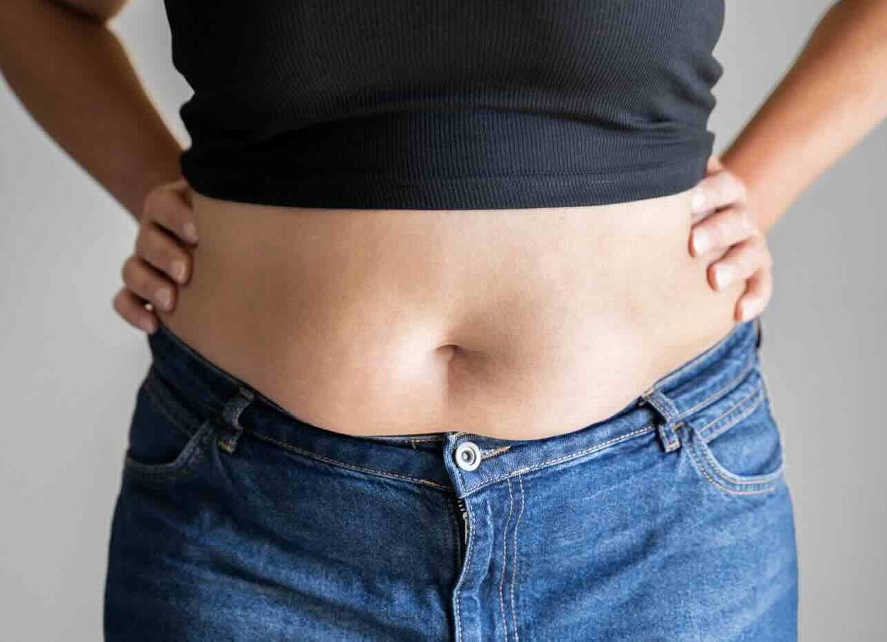 ایمپلنت لاغری برای چه کسی مناسب است