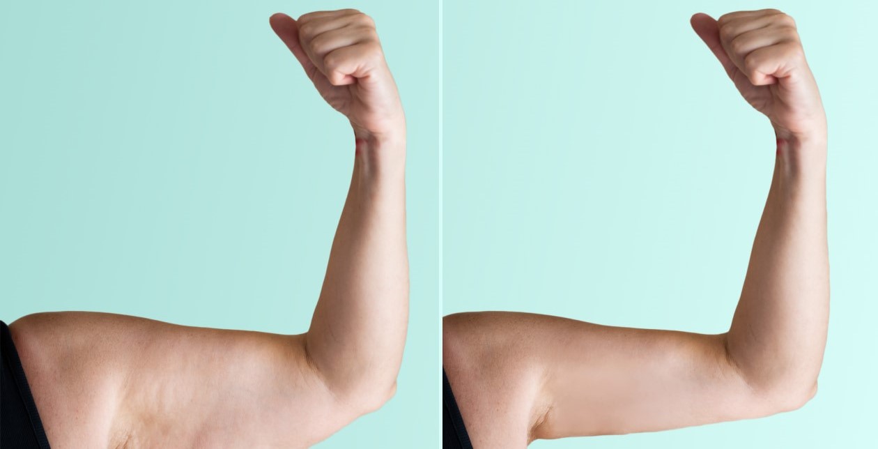 لاغری بازو - لاغری بالاتنه در یک هفته