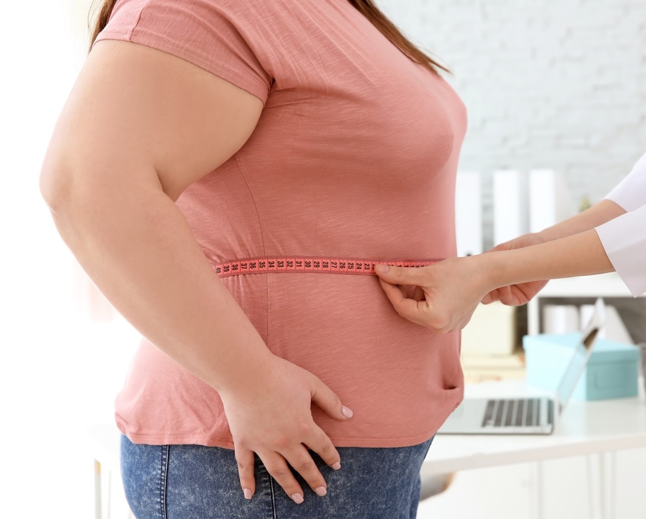 چاقی شکمی - درمان چاقی ژنتیکی