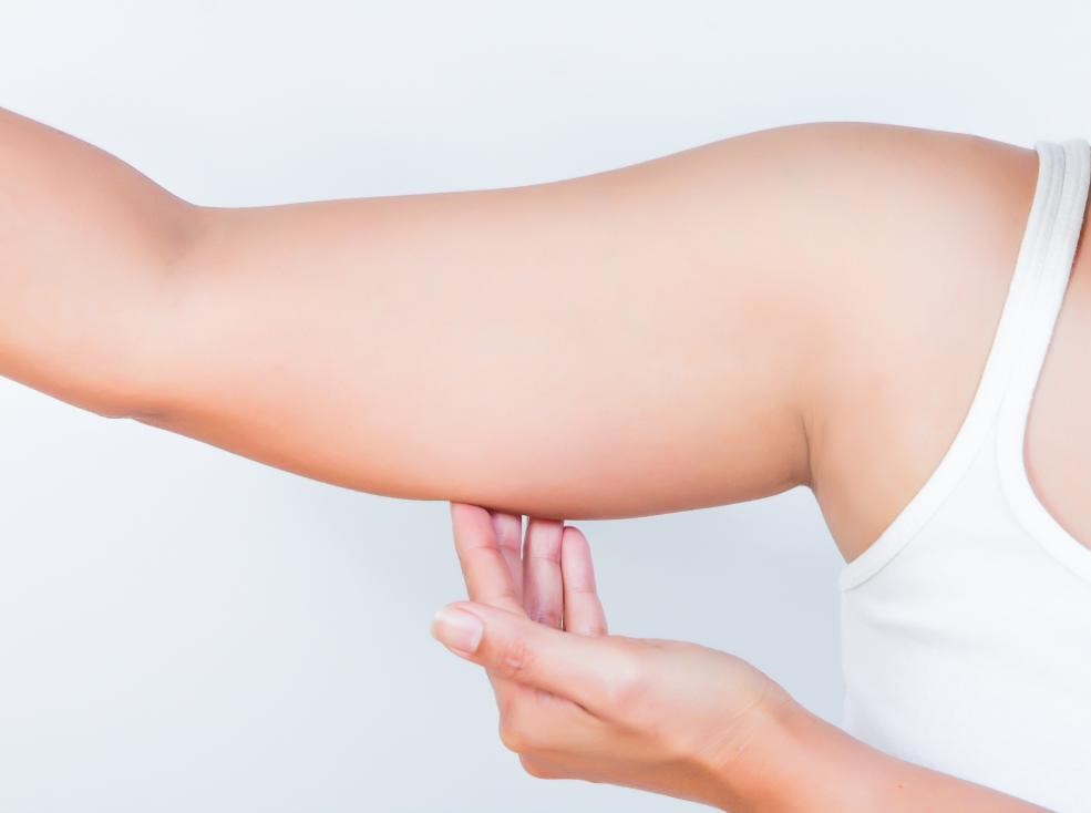 رفع افتادگی بازو - شل شدن پوست بعد از لاغری