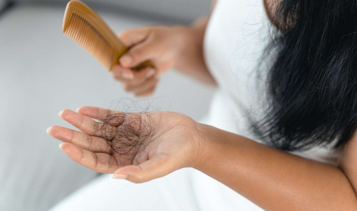 علت ریزش مو در رژیم لاغری