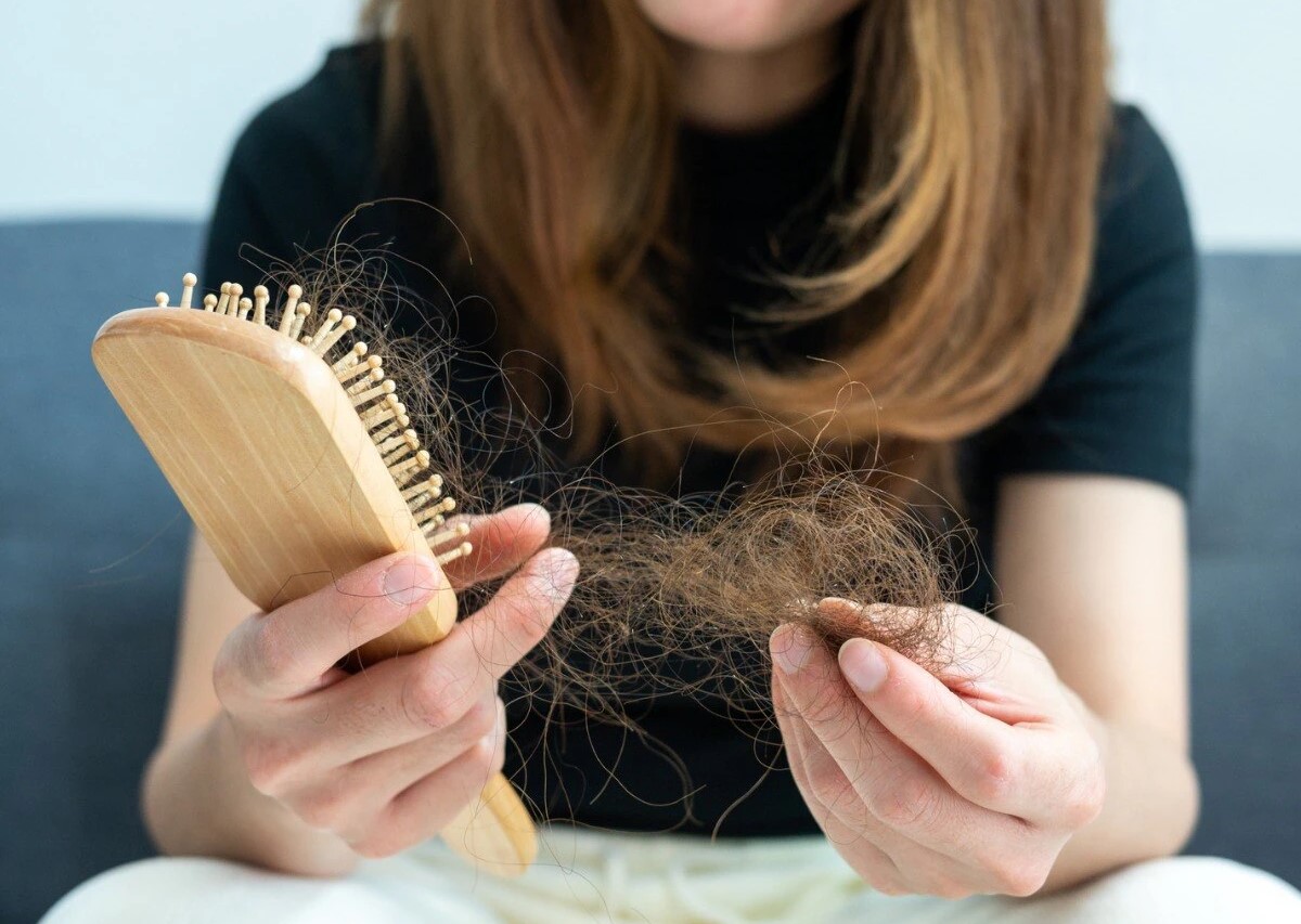 ریزش مو - ریزش مو در رژیم لاغری